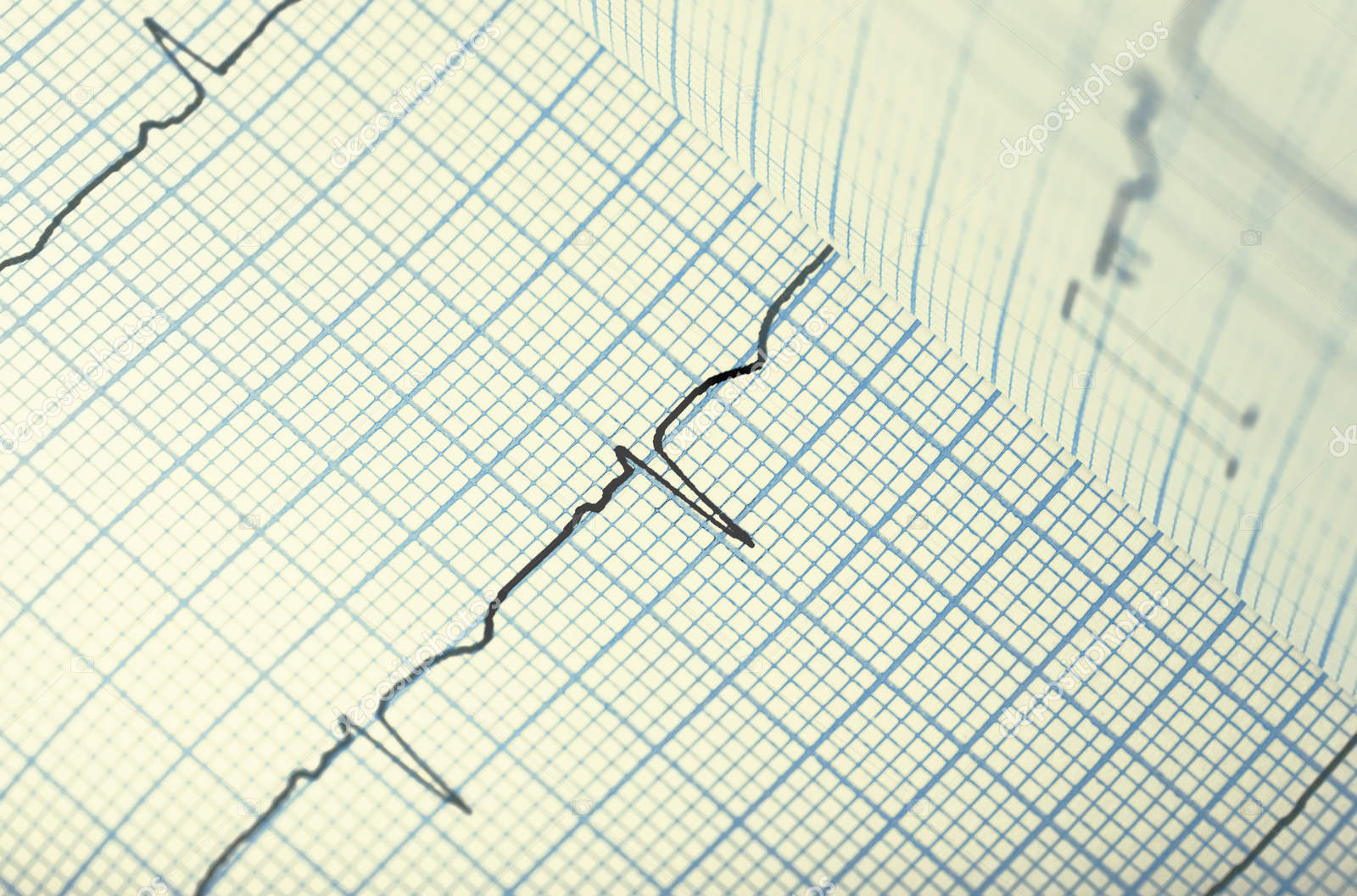 جهاز تخطيط القلب / رسم القلب EKG1212T · سوق البلد للاعلانات المجانية